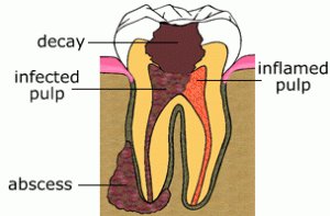 rct2