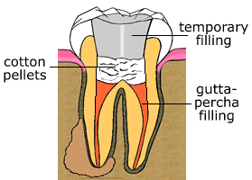 rct4